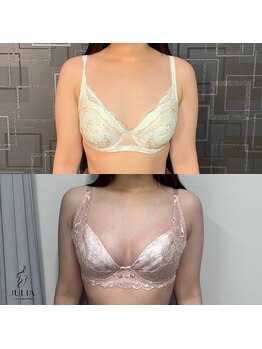 ジュリア(JULIA)/【バストアップ/育乳　症例】