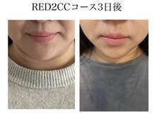 リッチベル(richbelle)