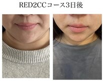リッチベル(richbelle)
