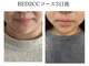 リッチベル(richbelle)の写真