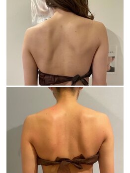 ルナグランデ(Luna grande.)/背中の凝りをほぐして姿勢を改善