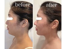 シンシアリー 広瀬通店(Sincerely)/before→after【お顔】