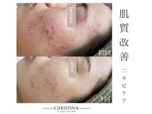 プシュケ(Psyche)/お客様の変化