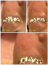 ビビアンローズ(BIBIAN ROSE)/まだまだもっとキレイに超ご期待