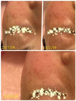 ビビアンローズ(BIBIAN ROSE)/まだまだもっとキレイに超ご期待