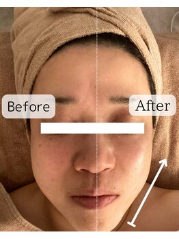 エヌミー(N me)/高濃度幹細胞エイジングケア