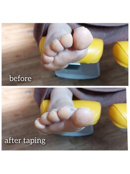 爪切り屋 足楽/