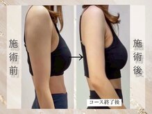 ミライ 福岡春日店(mirai)/なりたいを叶えるボディメイク