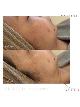 シェア(share.)/イラストリアス &nbsp;抜群の透明感！