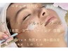 ピーリング＆肌改善！マイクロニードル再生ピーリングホワイトパック付き♪