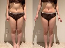 アンティアージュ 福岡本店(antiage)/楽して全身痩せ♪¥19,600