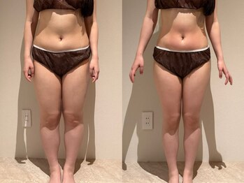 アンティアージュ 福岡本店(antiage)/楽して全身痩せ♪¥19,600