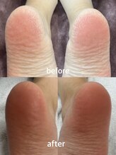 テソロ(Tesoro.)/フットケア