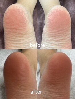 テソロ(Tesoro.)/フットケア