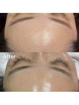 ランティル(l’until)/【ハリが出る！ツヤも出る！】