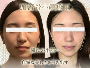 RHB 横浜店の写真/小顔になりたい方必見◎筋肉骨格からアプローチ！たるみ改善で土台から整え素顔美人へ