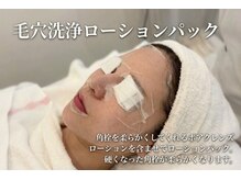 プランス 渋谷(PLANCE)/渋谷エステ/ニキビケア/