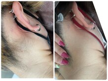 ビューティーホームサロン(Beauty Home Salon)/全身脱毛