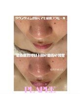 クリア 麻布十番(CLEAR)/プラピール　ビフォーアフター