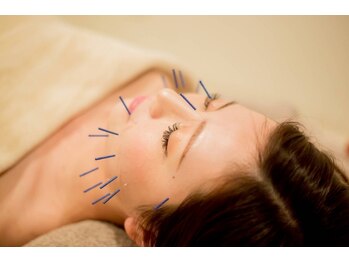 ナノフェイス 名古屋駅前店(nano face)の写真/《結果重視》首肩こり/頭痛/眼精疲労/小顔など悩みに合わせた最適な施術！小顔美容鍼×肩こり美容鍼¥3980