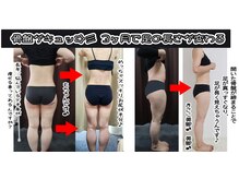 コンフィデンス 谷町四丁目店(Confidence)/足だけが痩せない・・・