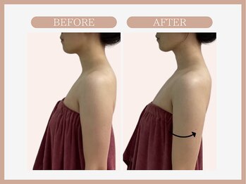 スリムライン 仙台店(The Slim Line)/before→after