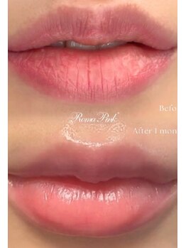 ツボミ(tubomi)/ローマピンク|唇…3