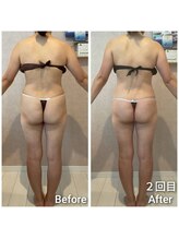 エミア(Emia)/全身痩せ×歪みケア120分　