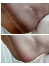 テソロ(Tesoro.)/フットケア