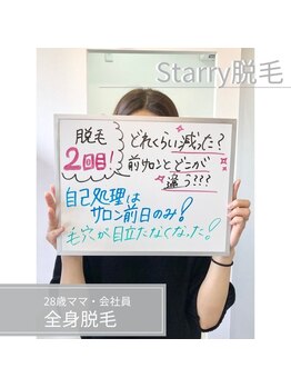 【都度払い脱毛】Coco starry 八代店【8/1 NEW OPEN(予定)】/他サロンと比べると…