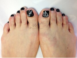 フット　ブラックネイル