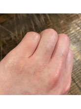 ナノハナ/鹿沼市の全身脱毛美容室ナノハナ