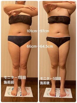 ライトウェーブ 諏訪インター店/くびれが出現!腿のハリ減少!