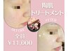 【次世代ハーブピーリング】陶肌トリートメント　¥11000～