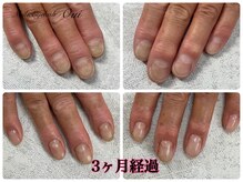 ウイ(Oui)/自爪育成