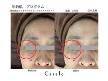 カラフ(Carafe)/年齢肌、再生プログラム