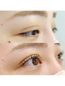 ソート(THOUGHT)/ラッシュリフト