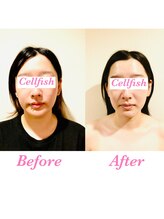 セルフィッシュ(Cellfish)/小顔＆全身矯正（ブライダル）