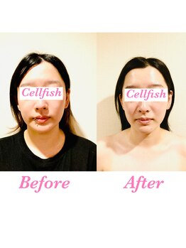 セルフィッシュ(Cellfish)/小顔＆全身矯正（ブライダル）