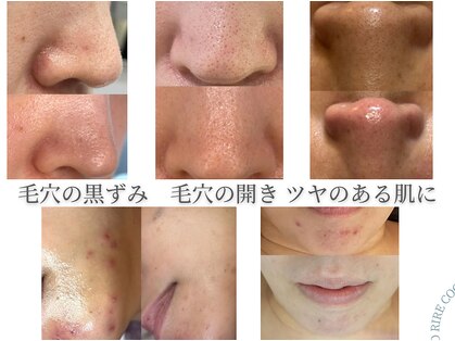 ココリールの写真