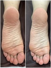 テソロ(Tesoro.)/フットケア