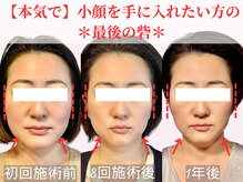 フレキシボディ(FlexiBody)