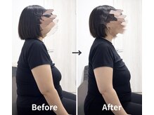 ジェイミープラス 表参道(J‘aimee +)/腰痛・肩こりビフォーアフター