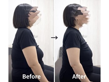 ジェイミープラス 表参道(J‘aimee +)/腰痛・肩こりビフォーアフター