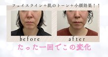 ヨサパーク ベル 福工大前店(YOSA PARK Belle)