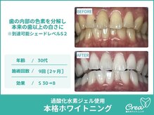 クレア(Crea)/【ホワイトニング症例写真】