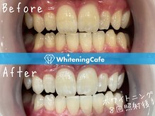 ホワイトニングカフェ 金山店(WhiteningCafe)