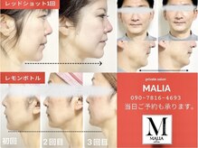 マリア(MALIA)の雰囲気(サロン人気ダントツNo.1レッドショット#美肌#毛穴#ハリにも◎)