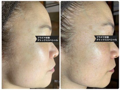サロン フェリシア(salon Felicia)の写真