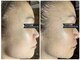 サロン フェリシア(salon Felicia)の写真
